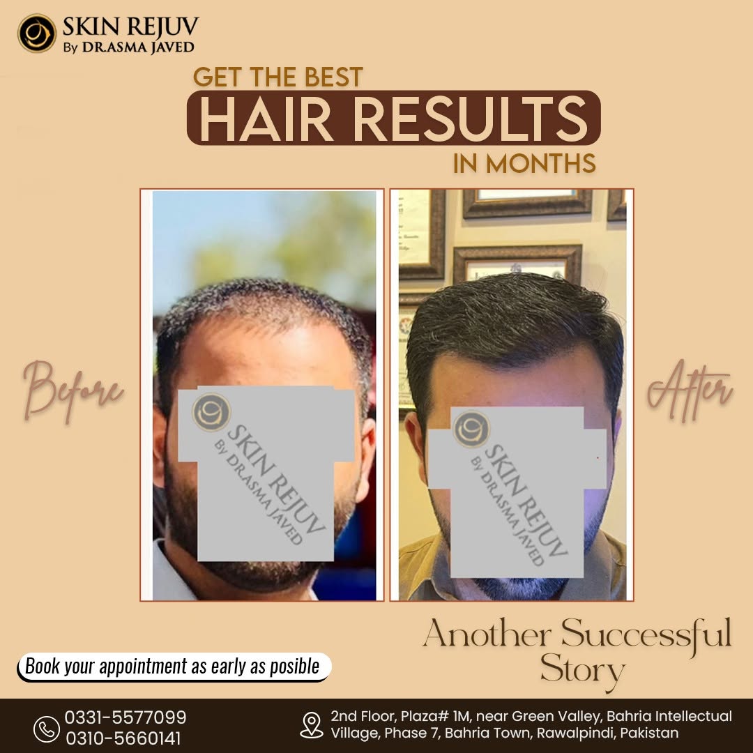 Before After Treatment 1